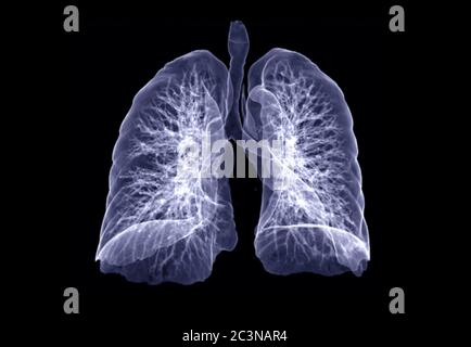 CT Chest or Lung 3D rendering image turn around on the screen for diagnosis TB,tuberculosis and covid-19 . Stock Photo
