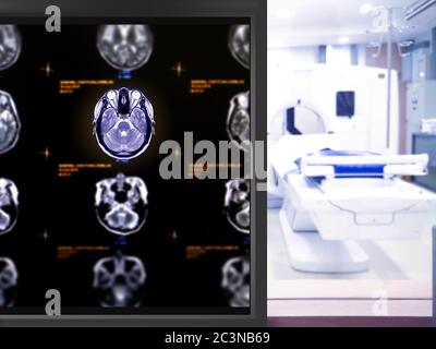 MRI Brain axial plane on the mornitor in MRI Scanner room at the ...