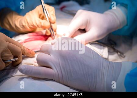 surgical suture. The hands of the surgeon and assistant in a sterile operating room impose a cosmetic suture on the skin of the patient's child. Stock Photo