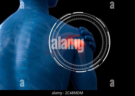 Shoulder pain anatomical vision x-ray. 3d illustration. Stock Photo