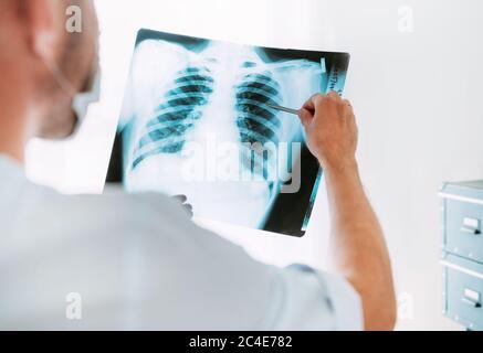 Male doctor examining the patient chest x-ray film lungs scan at radiology department in hospital.Covid-19 scan body xray test detection for covid wor Stock Photo