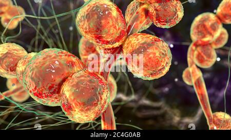 Computer illustration of the unicellular fungus (yeast) Candida ciferrii. C. ciferrii is a recently emerged fluconazole-resistant yeast that has been reported at an increasing rate as the cause of fungemia (bloodstream infection) and other systemic mycosis in immunocompromised patients. Stock Photo