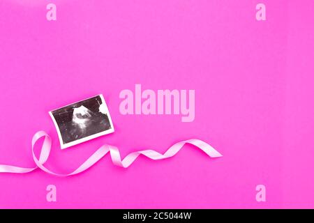 Ultrasound image of a baby with a pink ribbon on a pink background with place for text Stock Photo