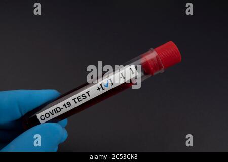 Laboratorian's hand is showing positive result covid-19 test tube in black abstract background. Stock Photo