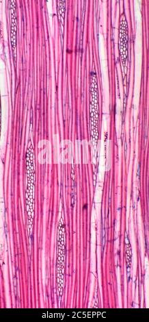 Brightfield photomicrograph, Devils walking stick tree, Aralia spinosa, cell structure, stem (trunk) detail Stock Photo