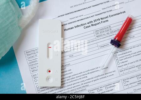 Negative test result by using rapid test for COVID-19, quick fast antibody point of care testing. Stock Photo