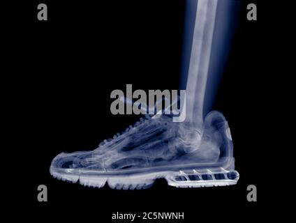 Foot and ankle in a running shoe, coloured X-ray. Stock Photo
