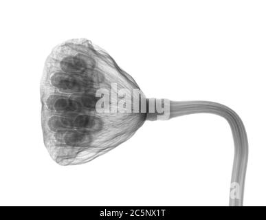 Lotus seed head, X-ray. Stock Photo