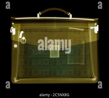 Case containing money, coloured X-ray. Stock Photo