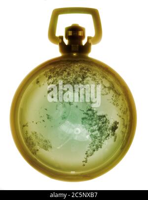 Stopwatch with globe, coloured X-ray. Stock Photo