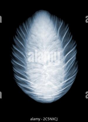Norway spruce (Picea abies) cone, coloured X-ray. Stock Photo