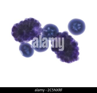 Blackberries and blueberries, coloured X-ray. Stock Photo