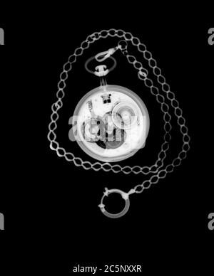 Pocket watch and chain, X-ray. Stock Photo