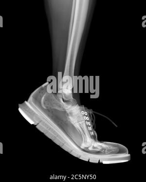 Skeleton lower leg in brogue footwear walking, X-ray. Stock Photo
