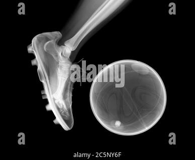 Foot in action kicking a football, X-ray. Stock Photo