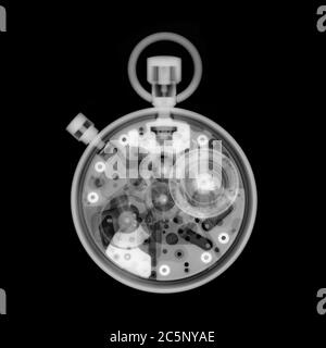 Stopwatch, X-ray. Stock Photo