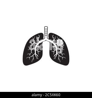 Lung cancer concept vector illustration Stock Vector Image & Art - Alamy