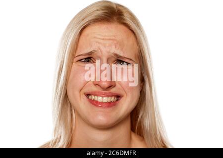 Young blonde with pimples on her forehead making a funny faces Stock Photo