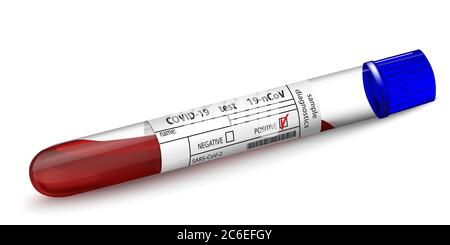 Test tube with blood sample for diagnostics Covid 19 virus. Positive result Form for test result Coronavirus 2019-nCoV. Realistic glass 3d Isolated on Stock Vector