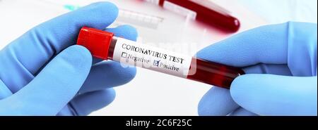 Panorama of Coronavirus testing. Doctor hand in medical glove holding test tube with Coronavirus positive blood over laboratory desk. Stock Photo