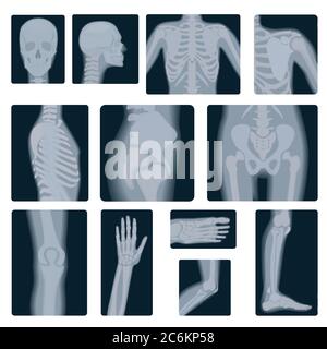 Extreme quality realistic vector collage set of many X-rays shots. X-ray multiple part of adult people Stock Vector