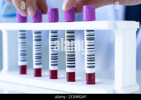 Hands of a lab technician with blood test sample tubes in a row for laboratory blood analysis. Stock Photo