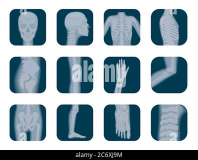 Vector realistic X-ray skeleton icons set. Human Skeleton xray elements. Body parts icon Stock Vector