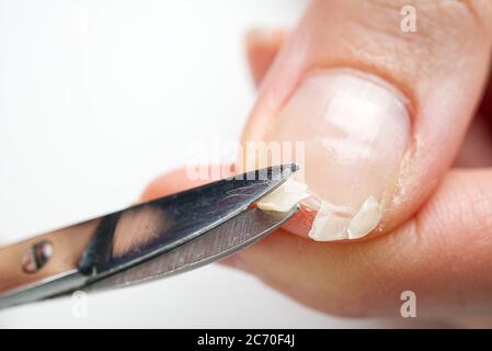 broken nail on a female hand. close-up shoot of broken nail. Stock Photo