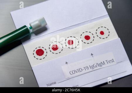 Dry blood spots on a collection card for Covid-19 IgG/IgM antibody screening Stock Photo