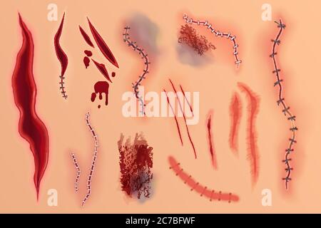 Abstract seamless pattern with various bloody wounds and injuries on skin-toned background Stock Vector