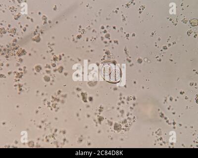 isospora spp oocyst under microscope Stock Photo