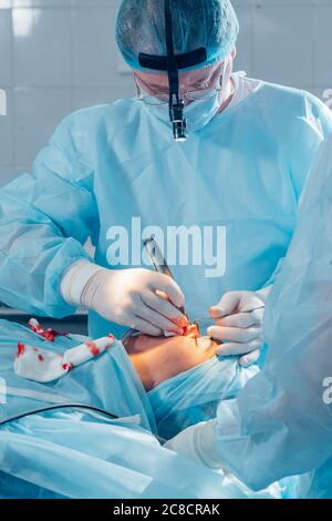 Surgeon performing cosmetic surgery on nose in hospital operating room. Surgeon in mask wearing surgical loupes during medical procedure. Stock Photo