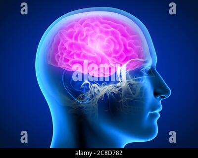 3d rendered medically accurate illustration of a man having a painful brain. Stock Photo