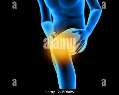 3d rendered medically accurate illustration of a man having a painful knee. Stock Photo