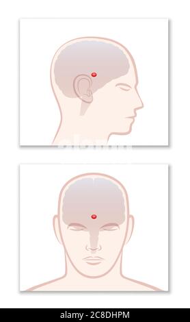 Pineal gland. Profile and frontal view with location in the human brain - illustration on white background. Stock Photo