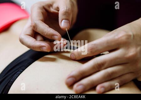 Physiotherapist treating patient for upper back pain with ultrasonic device  Stock Photo by svitlanah