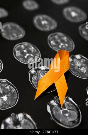 Awarenesss ribbon orange, sign of solidarity, ribbon, lying on MRI scan of the head of a young woman with multiple sclerosis Stock Photo