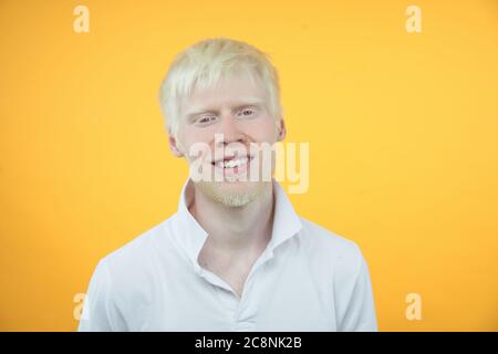 Happy smiling albino man white skin hair studio dressed t-shirt isolated yellow background abnormal deviations unusual appearance abnormality Beautiful people Stock Photo