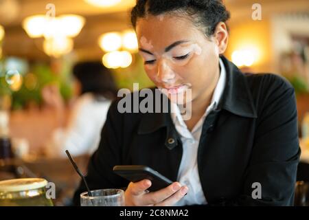 A beautiful young girl of African ethnicity with vitiligo sitting in a restaurant close up portrait of woman with skin problems. Stock Photo