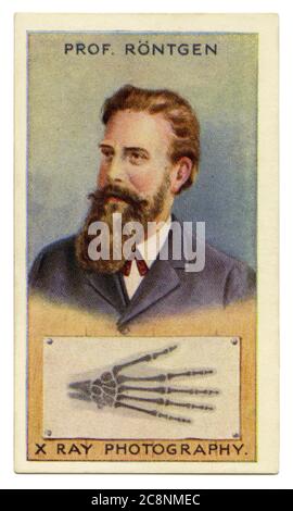 An old cigarette card (c. 1929) with a portrait of Wilhelm Conrad Röntgen (1845–1923) and an illustration of an X-ray of the bones of a human hand. Röntgen was a German mechanical engineer and physicist, who, in 1895, produced and detected electromagnetic radiation in a wavelength range known as X-rays or Röntgen rays, an achievement that earned him the first Nobel Prize in Physics in 1901. Röntgen saw the first radiographic image: his own skeleton on the barium platinocyanide screen. A few weeks after his discovery, he took a picture (a radiograph) using X-rays of his wife's hand. Stock Photo