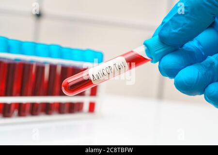 Blood sample   test tube in doctor hand for   anti-CCP /  rheumatoid arthritis disease test Stock Photo