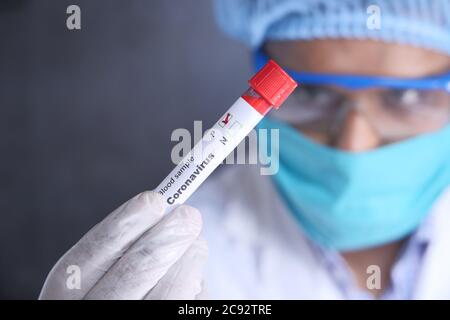 laboratory technician testing corona virus , COVID 19 test. Stock Photo