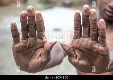 Wrinkled skin of the hands because of long time in water Stock Photo ...