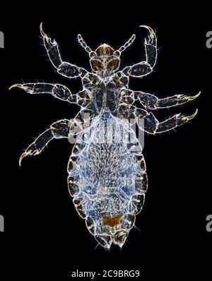 Head louse (Pediculus humanus capitis) darkfield photomicrograph Stock Photo
