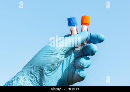 Hands with blue gloves holding two test tubes full of blood blue sky Stock Photo
