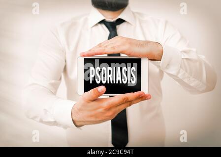 Writing note showing Psoriasis. Business concept for chronic skin disease characterized by patches with white scales Model displaying black screen mod Stock Photo