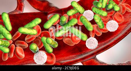 Bacterial blood infection, computer illustration. Stock Photo