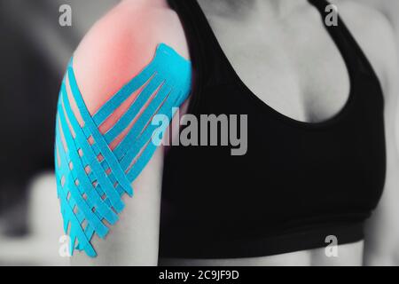 Physical therapist placing kinesio tape on patient's shoulder. Stock Photo