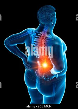 Obese man with back pain, computer illustration. Stock Photo