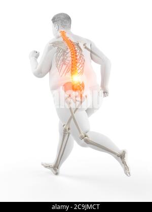 Obese runner with back pain, computer illustration. Stock Photo